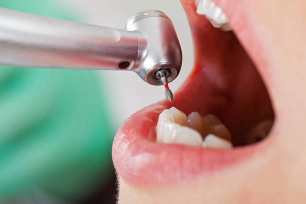 Best Urgent Dental Care for Toothache in Exmore, VA